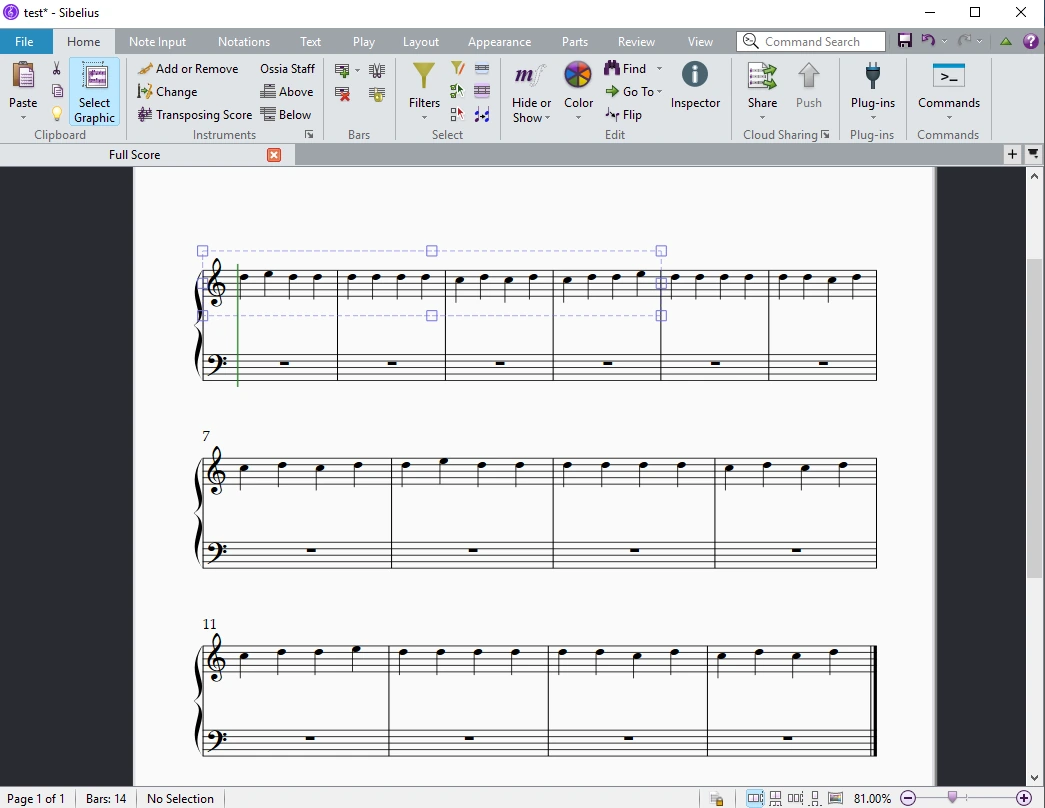 Official Sibelius desktop interface from Avid's public knowledge base
